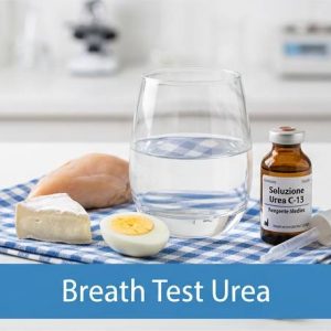 Breath Test Urea - Helicobacter Pylori